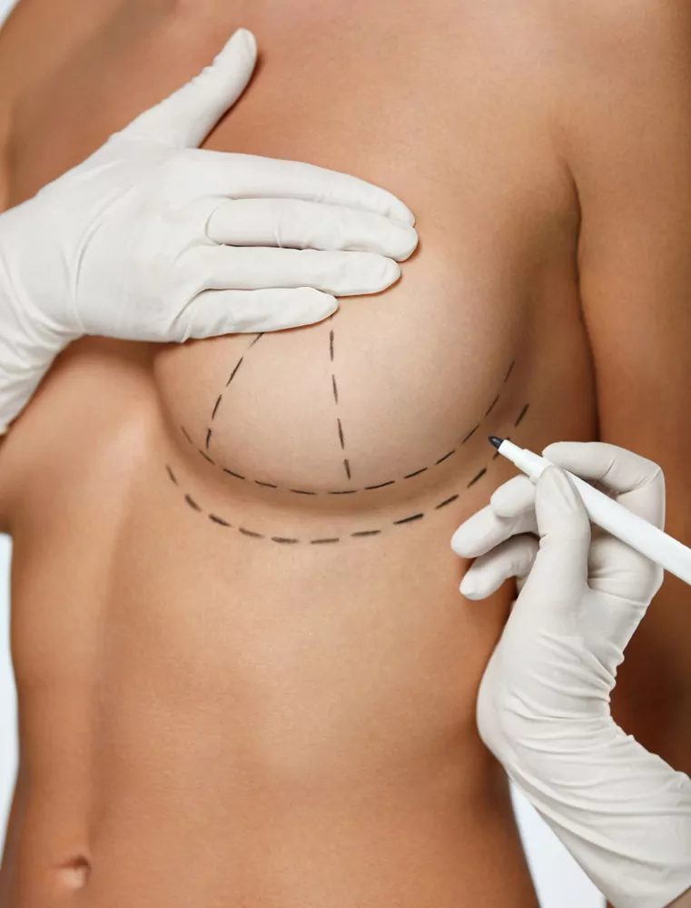 Réduction mammaire | Docteur Irthum